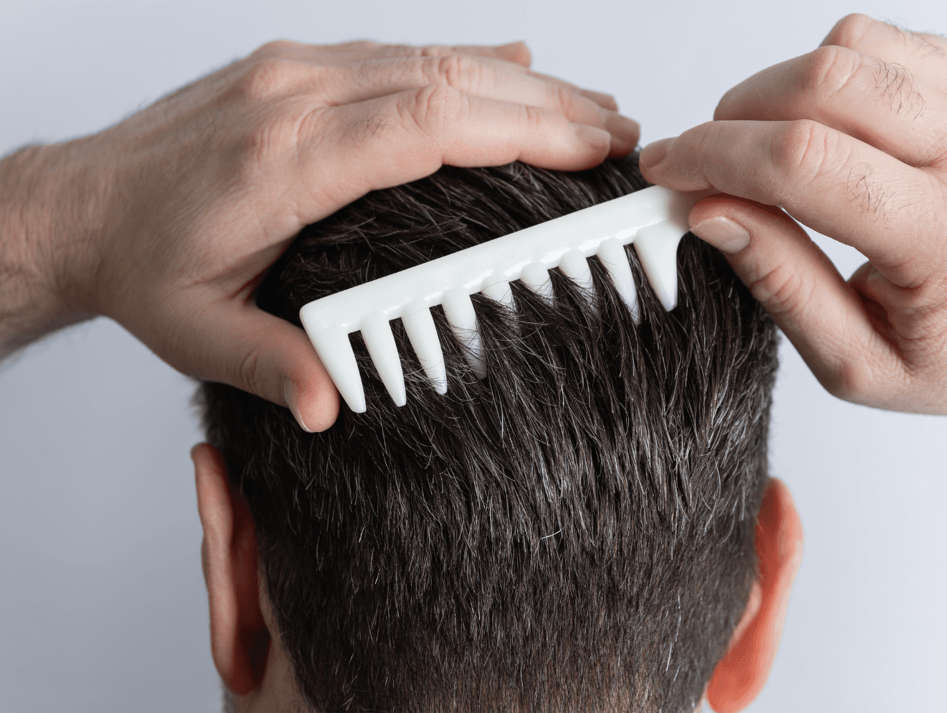 Client receiving a professional hair system refit to ensure secure bonding and natural appearance at a salon in Weymouth