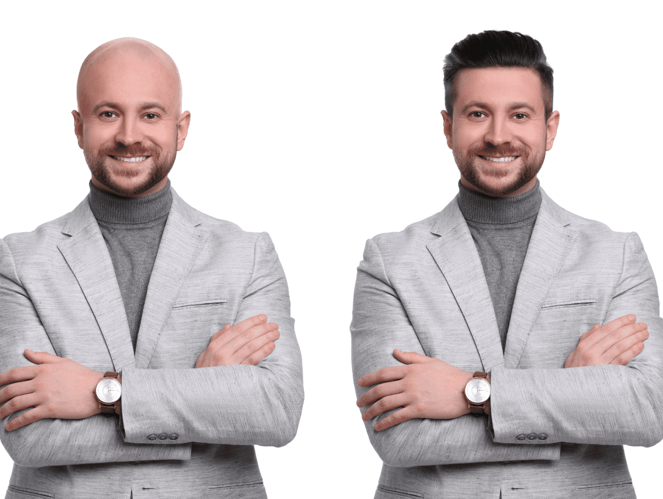 Before and after photo of male client wearing a non-surgical hair system, showing realistic hair restoration results from a Weymouth salon